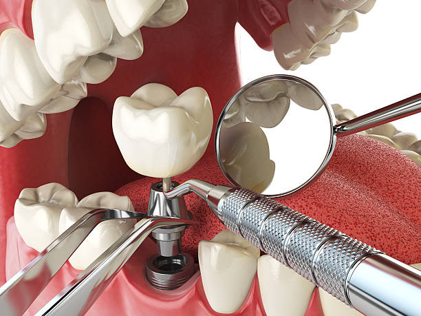 Best Emergency Care for Gum Disease in Lyons, CO